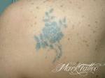 mark-tattoo-torrejon-ardoz-tatuaje-laser-eliminar