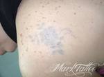 mark-tattoo-torrejon-ardoz-tatuaje-laser-eliminar