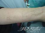mark-tattoo-torrejon-ardoz-tatuaje-laser-eliminar