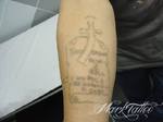 mark-tattoo-torrejon-ardoz-tatuaje-laser-eliminar
