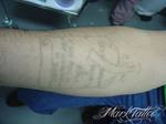 mark-tattoo-torrejon-ardoz-tatuaje-laser-eliminar