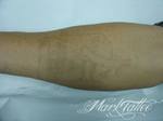 mark-tattoo-torrejon-ardoz-tatuaje-laser-eliminar