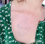 mark-tattoo-torrejon-ardoz-tatuaje-laser-eliminar