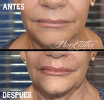 mark-tattoo-torrejon-ardoz-tatuaje-facial-labios