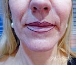 mark-tattoo-torrejon-ardoz-tatuaje-facial-labios