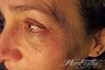 mark-tattoo-torrejon-ardoz-tatuaje-facial-raya-ojo